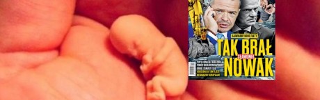 „Sieci”: Niczym wycięcie wyrostka