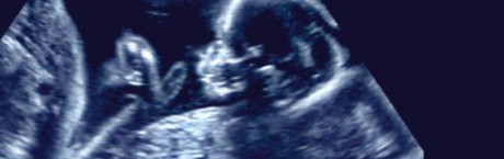 „Sieci”: Tajemnica nienarodzonych